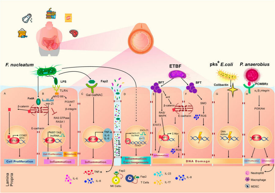 Imagem Efeito-da-Dieta-Ocidental-no-Microbioma-Intestinal